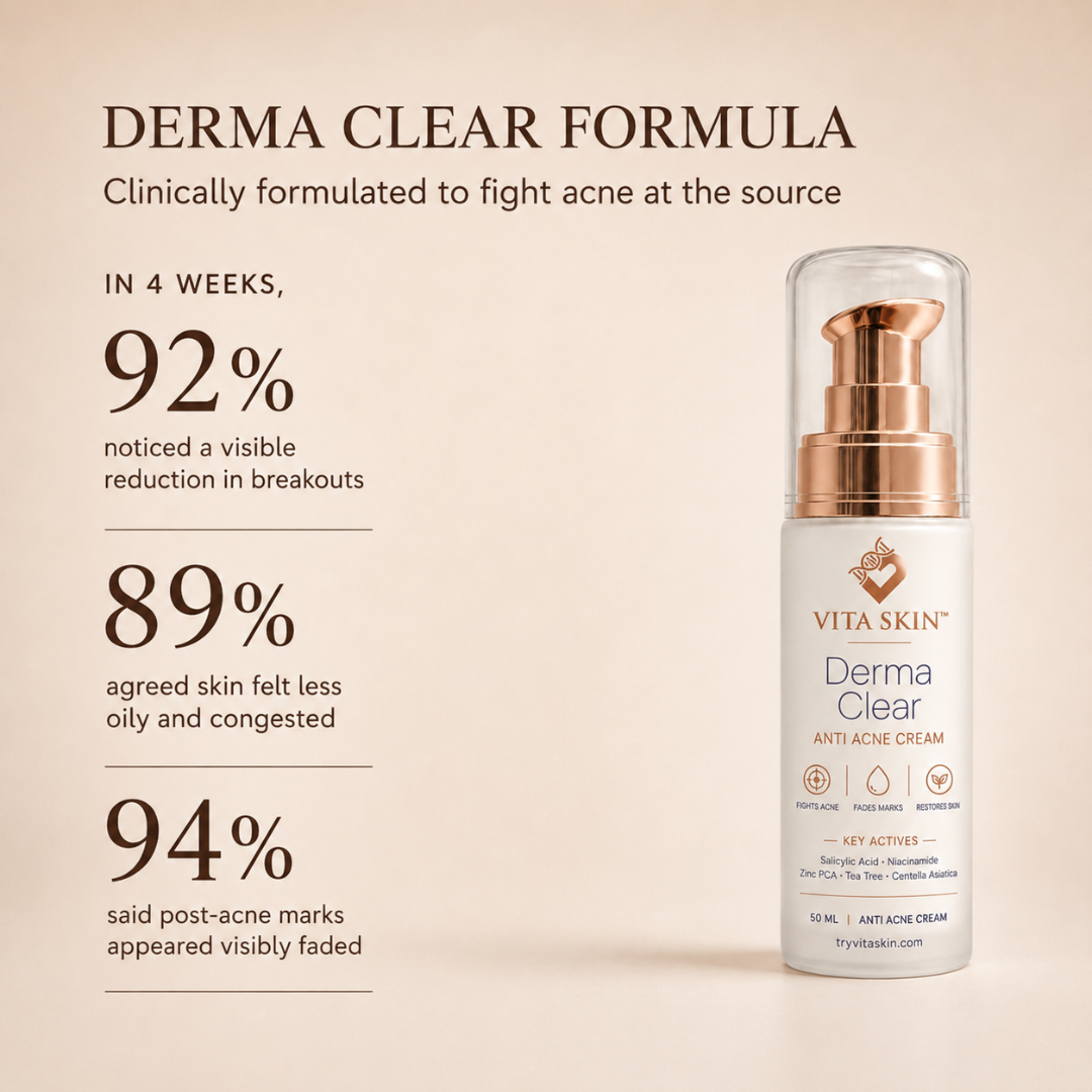 Derma Clear Anti Acne Cream with rose gold pump, clinically formulated to reduce breakouts and fade post-acne marks