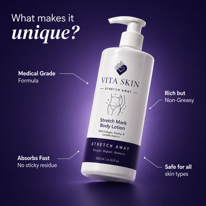 Vita Skin™ StretchAway Body Lotion