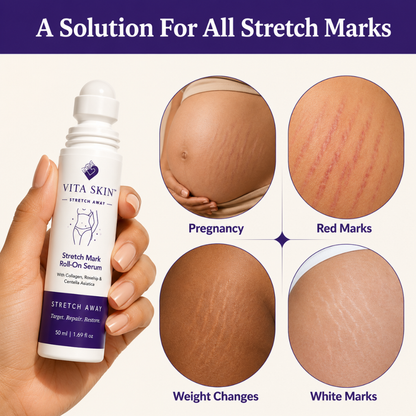 Vita Skin™ StretchAway