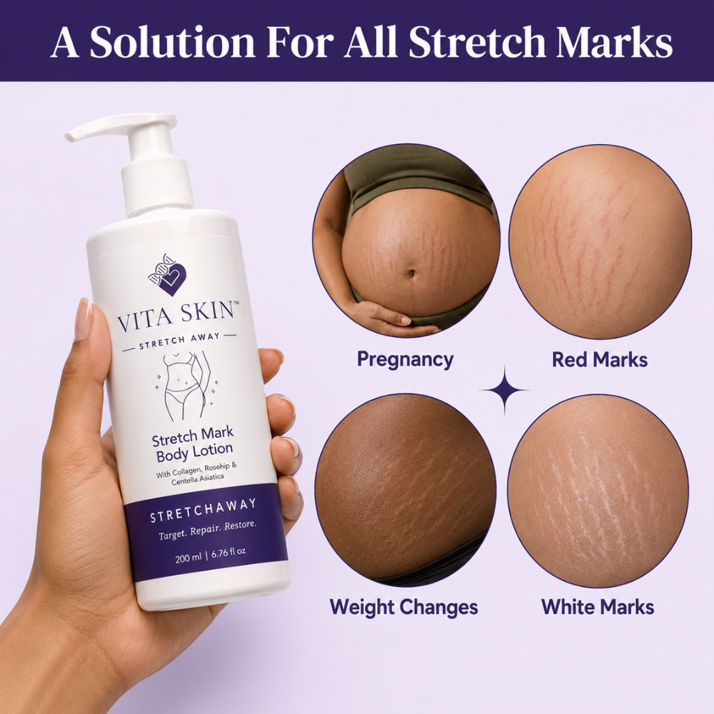 Vita Skin™ StretchAway Body Lotion