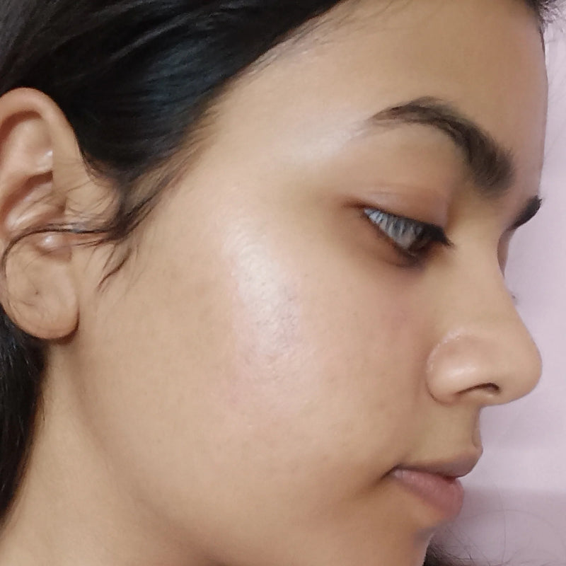Visibly brighter even skin tone after using DarkSpot RX Serum