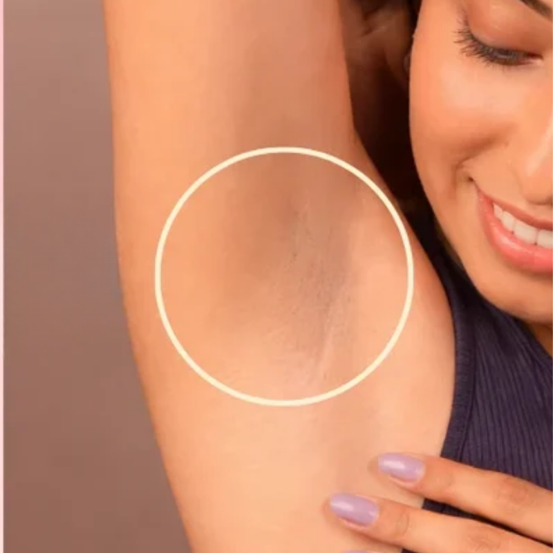 Brighter underarms after using Pretty Pits