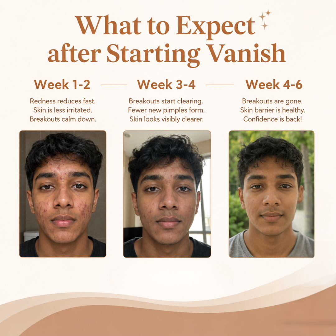 Acne treatment progress: Week 1-2 redness reduction, Week 3-4 clearer skin, Week 4-6 breakout-free results
